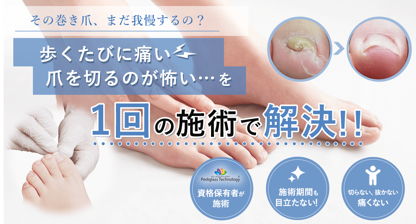 福岡市で巻き爪を改善するなら、福岡巻き爪治療院へご相談ください