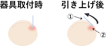 器具の取り付け、補正