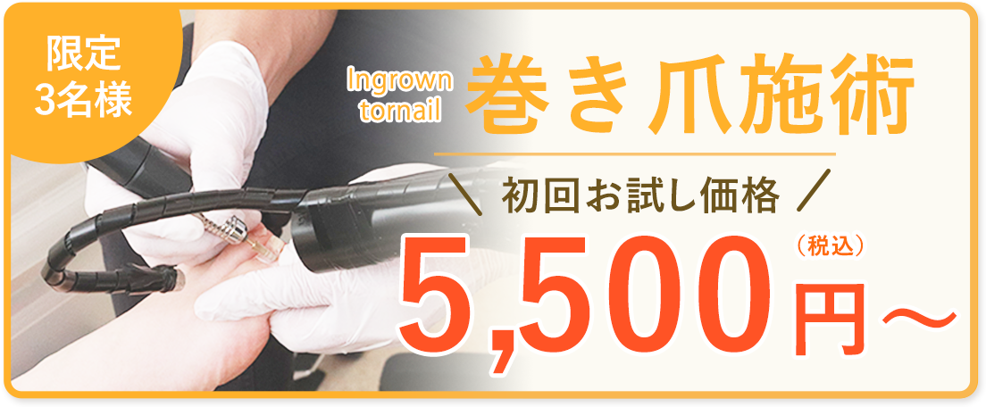 限定3名様初回お試し価格