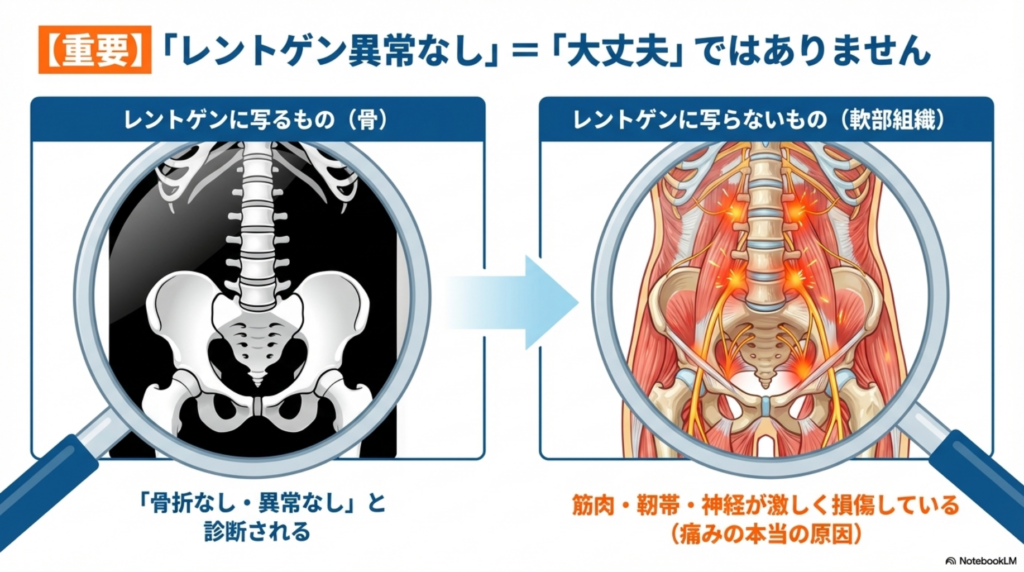 「レントゲンで異常なし」は安心できない