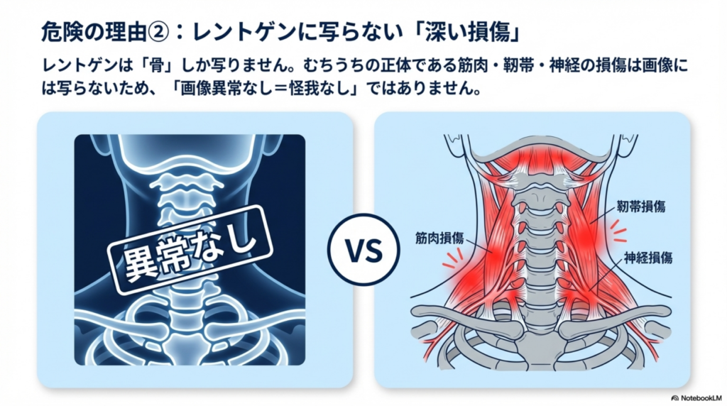 むち打ちはレントゲンには映らない