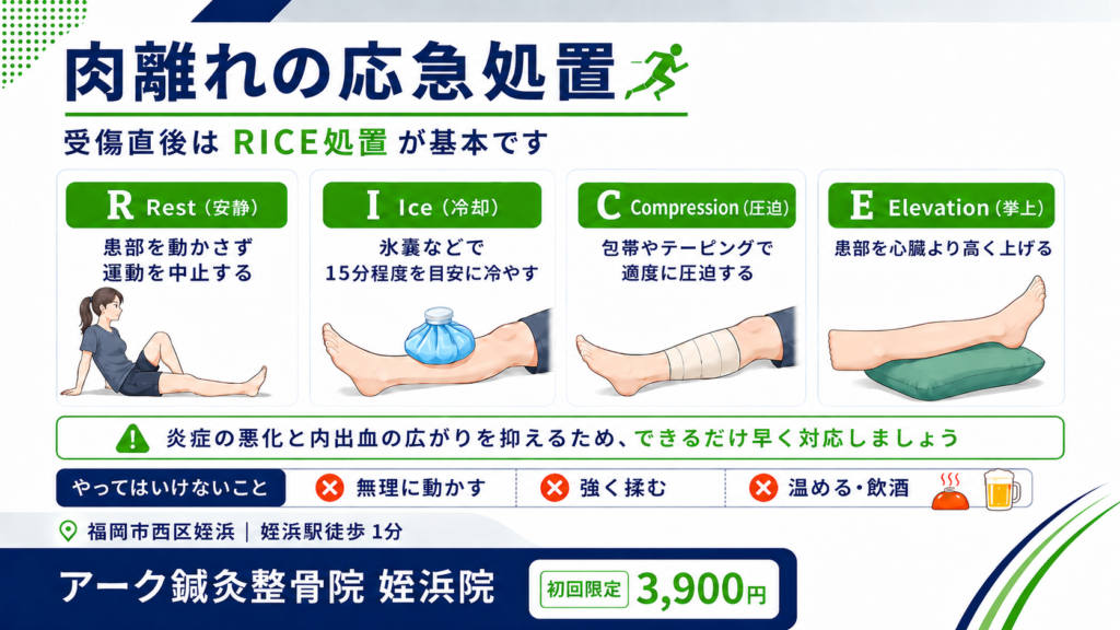 肉離れの応急処置