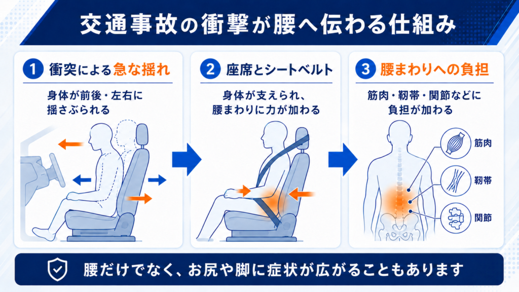 交通事故の衝撃によって腰の筋肉や靱帯、関節へ負担が加わる仕組み