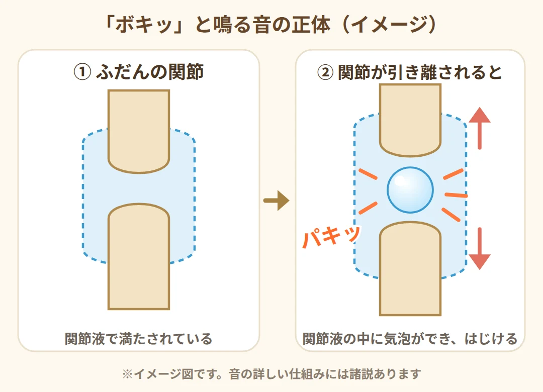 関節が引き離されると関節液の中に気泡ができ、はじけて音が鳴る仕組みのイメージ図