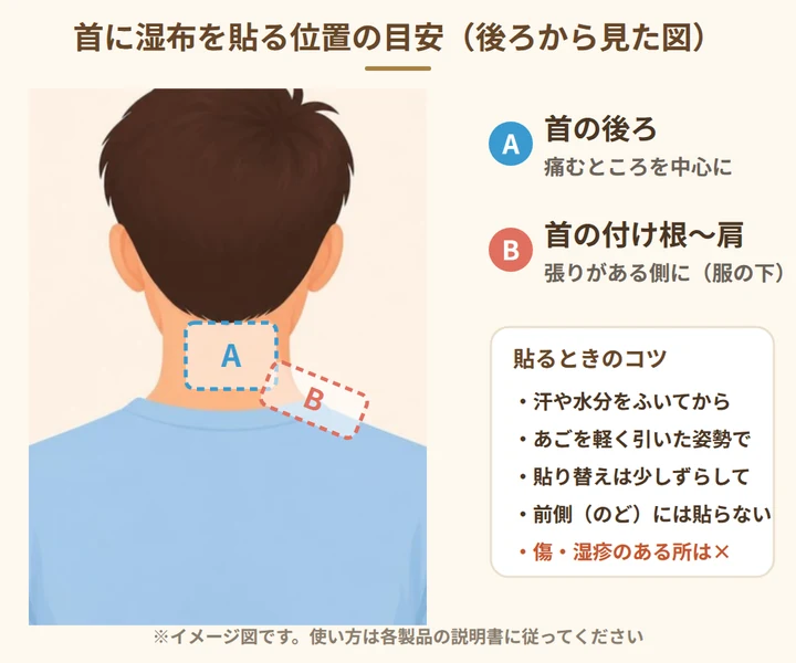 首に湿布を貼る位置の目安。A:首の後ろの痛むところ、B:首の付け根から肩の張りがある側。汗をふいてから、あごを軽く引いた姿勢で貼り、貼り替えは少しずらす。傷や湿疹のある所には貼らない